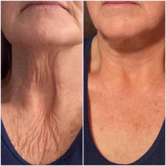 ageLOC® Dermatic Effects™ Body Contouring Lotion/Hibiscus Firming Cream - Picture 8 of 10